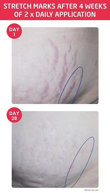 Weleda Mum Stretch Mark Body Butter Weleda